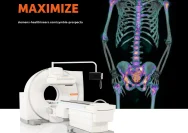 Inovasi Terkini dalam Deteksi Kanker: SPECT/CT Symbia Pro.Specta Hadir di Indonesia
