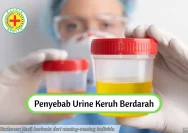 Mengatasi Kebocoran Urine saat Hamil: Penyebab dan Cara Menguranginya