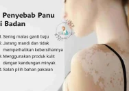 Mengenal Berbagai Jenis Panu: Panduan Lengkap untuk Identifikasi yang Akurat