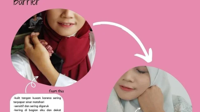 Abel Cantika Berbagi Pengalaman Menjaga Skin Barrier untuk Mengatasi Masalah Kulit Kering