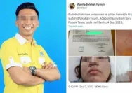 Anggota DPRD Golkar Fahruddin Dipidana Rp30 Juta atas Kasus Pembongkaran Bollard