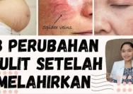 Mengenal Perubahan Warna Kulit Perut Setelah Melahirkan